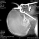 Illustration for article titled Man Drops Pruning Shears, Falls Eyesocket-First Onto Pruning Shears